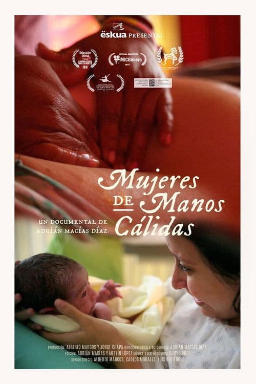 Mujeres de manos cálidas